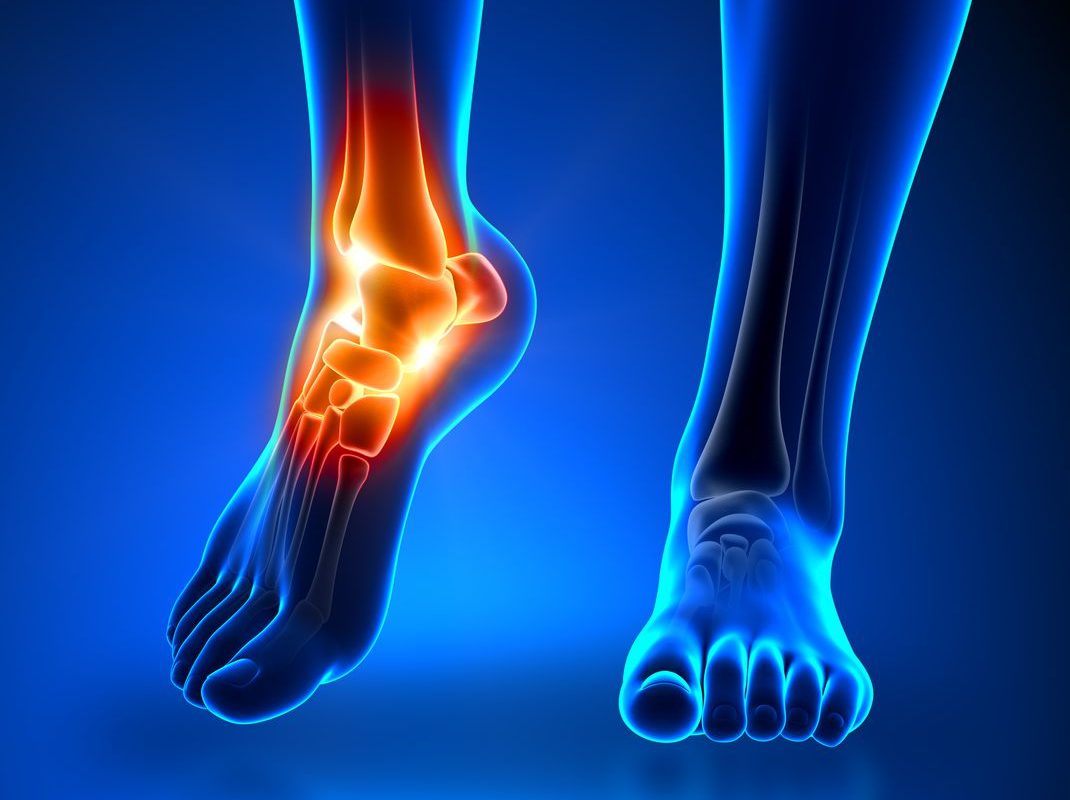 ANKLE REHABILITATION